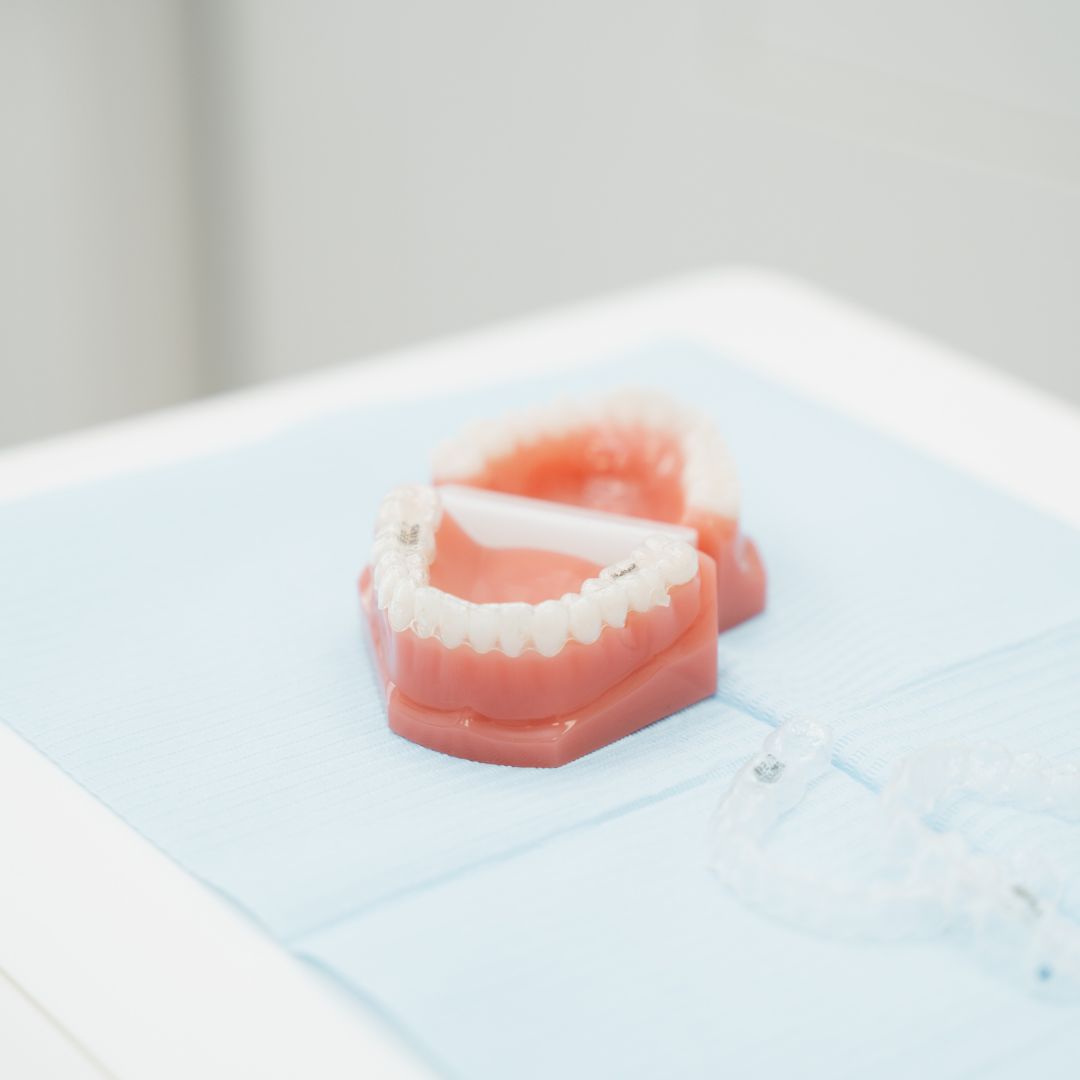 Teeth Whitening - 740 Dental Teeth Whitening - 740 Dental