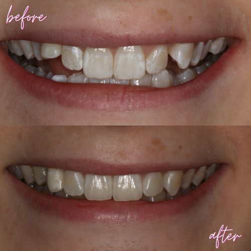 Cosmetic Dentistry - 740 Dental Cosmetic Dentistry - 740 Dental