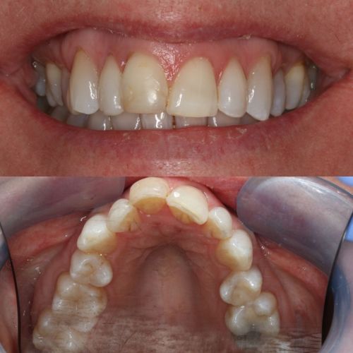 Cosmetic Dentistry - 740 Dental Cosmetic Dentistry - 740 Dental