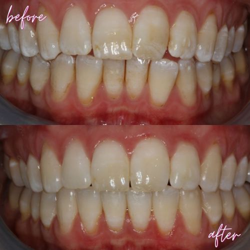 Cosmetic Dentistry - 740 Dental Before and After - Cosmetic dentistry