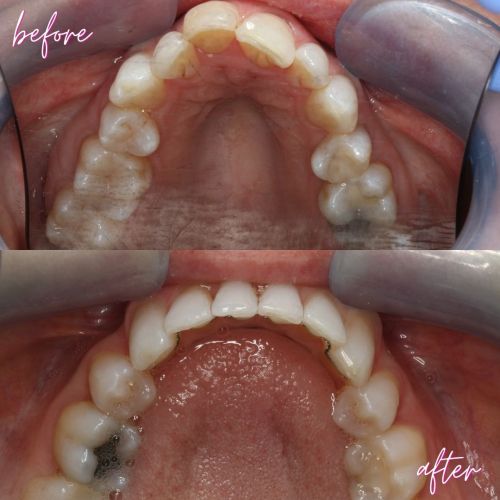 Cosmetic Dentistry - 740 Dental Cosmetic Dentistry - 740 Dental