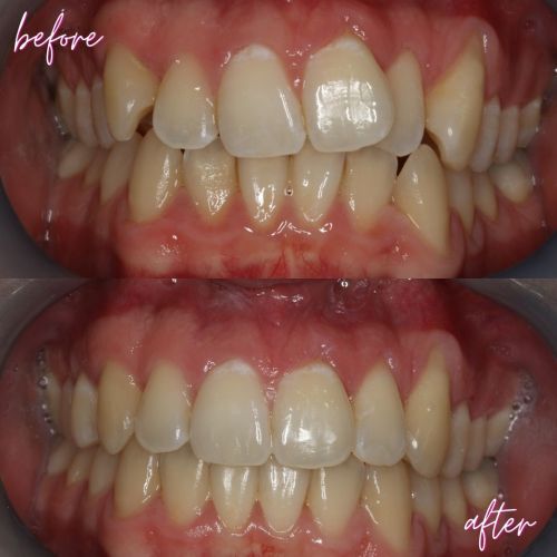 Cosmetic Dentistry - 740 Dental Cosmetic Dentistry - 740 Dental