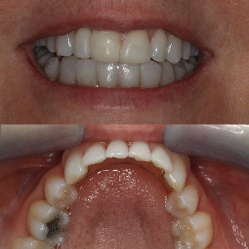 Cosmetic Dentistry - 740 Dental Cosmetic Dentistry - 740 Dental
