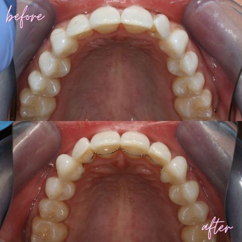 Cosmetic Dentistry - 740 Dental Cosmetic Dentistry - 740 Dental