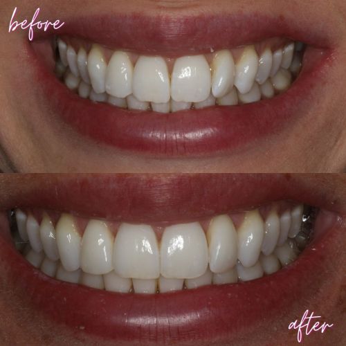 Cosmetic Dentistry - 740 Dental Cosmetic Dentistry - 740 Dental